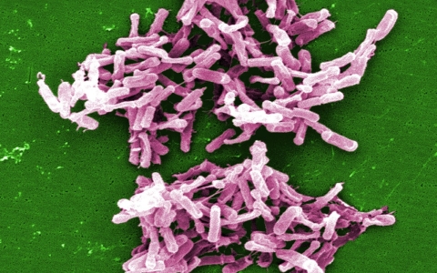 This micrograph depicts Gram-positive C. difficile bacteria from a stool sample culture.