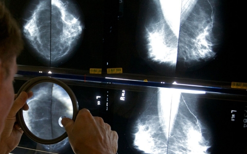 mammogram