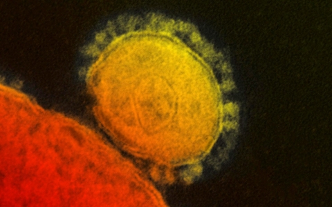 Thumbnail image for Hospital workers in contact with MERS patient display flu-like symptoms