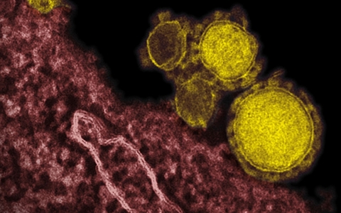 Thumbnail image for First U.S. MERS case found in patient recently returned from Saudi Arabia