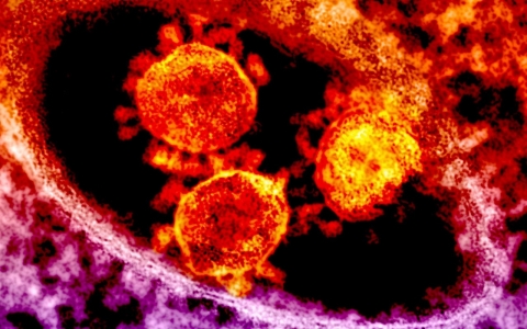 Thumbnail image for MERS virus spreads to Iran