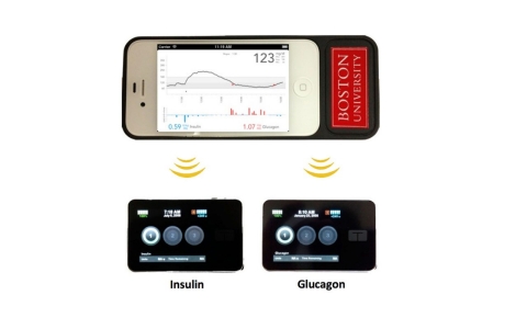 Thumbnail image for ‘Bionic pancreas’ shows promise for Type 1 diabetes