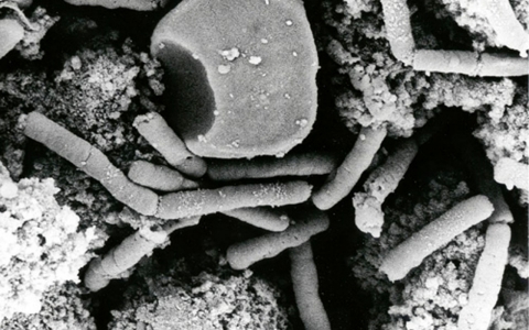 Thumbnail image for CDC scientists may have accidentally been exposed to anthrax