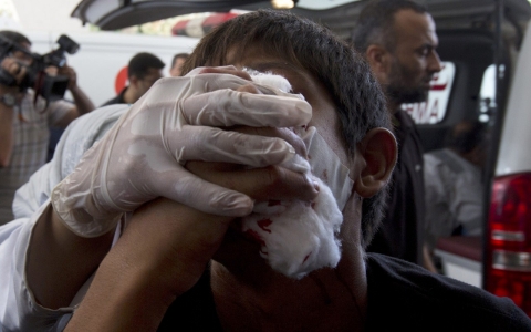 Thumbnail image for Gaza hospitals struggle to treat injured in latest Israeli airstrikes