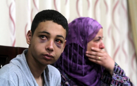 Thumbnail image for Family urges US to lobby Israel over plight of beaten American teen