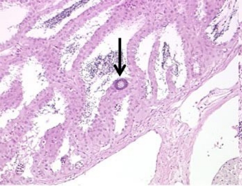 Slide showing smallmouth bass with one oocyte (arrow) low severity