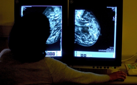 Breast cancer rates rising among African-American women