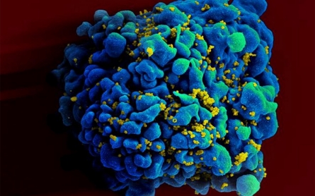 New HIV infections in gay black men may be leveling off