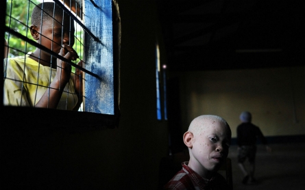 Tanzania police arrest hundreds of witchdoctors for murdering albinos