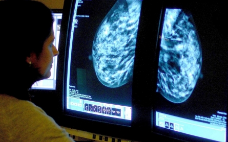 Genetic test shows which breast cancer patients can skip chemotherapy