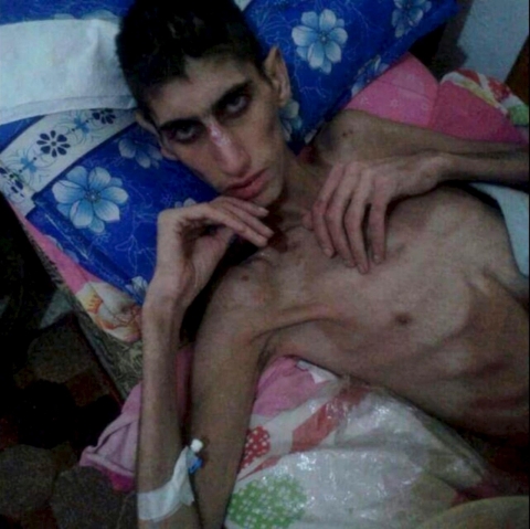 Madaya Syria