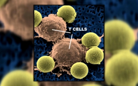 Using altered HIV cells, leukemia treatment shows long-term remissions