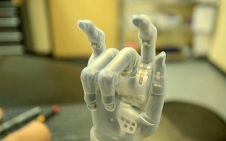 Need to Know: New bionics technology aims to fit every need